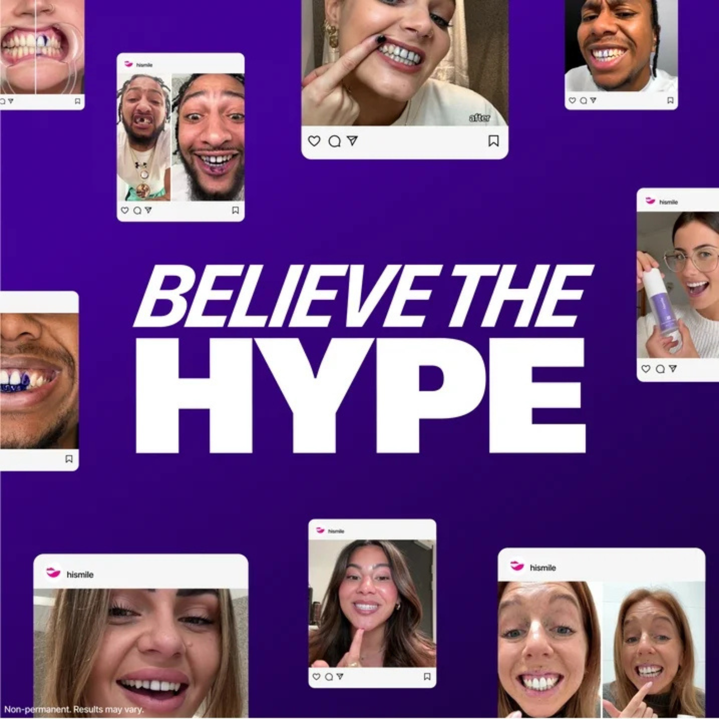 Hismile V34 Colour Corrector Serum – Advanced Teeth Whitening Purple Toner – Instant Colour Correcting Formula for Brighter, Whiter Smile – Enamel-Safe Tooth Brightening Booster for Daily Use