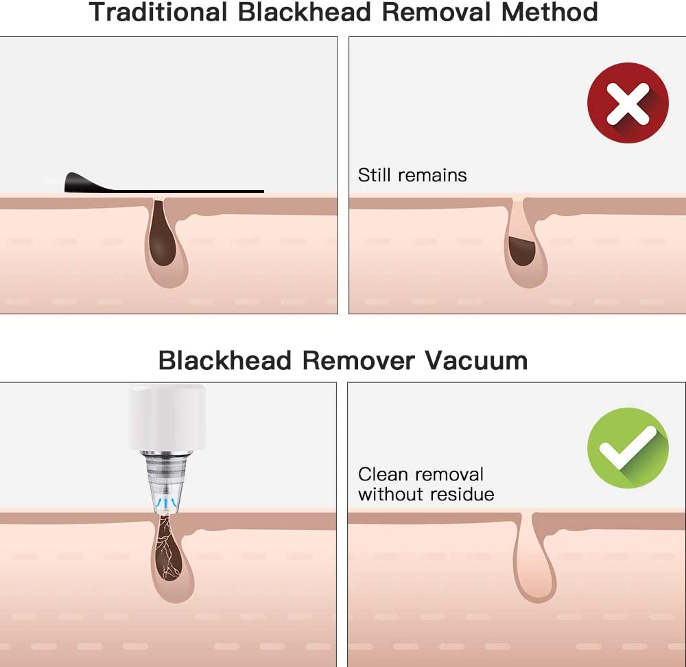 Blackhead Remover DIOZO Professional Pore Vacuum Rechargeable Blackhead Remover Vacuum Pore Cleaner with 3 Adjustable Suction Power 4 Replacement Probes for Removing Blackhead,Spot,Acne