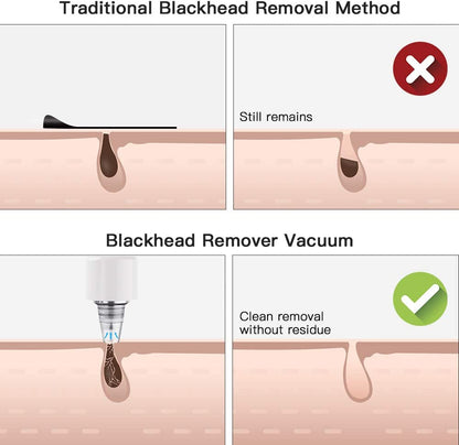 Blackhead Remover DIOZO Professional Pore Vacuum Rechargeable Blackhead Remover Vacuum Pore Cleaner with 3 Adjustable Suction Power 4 Replacement Probes for Removing Blackhead,Spot,Acne