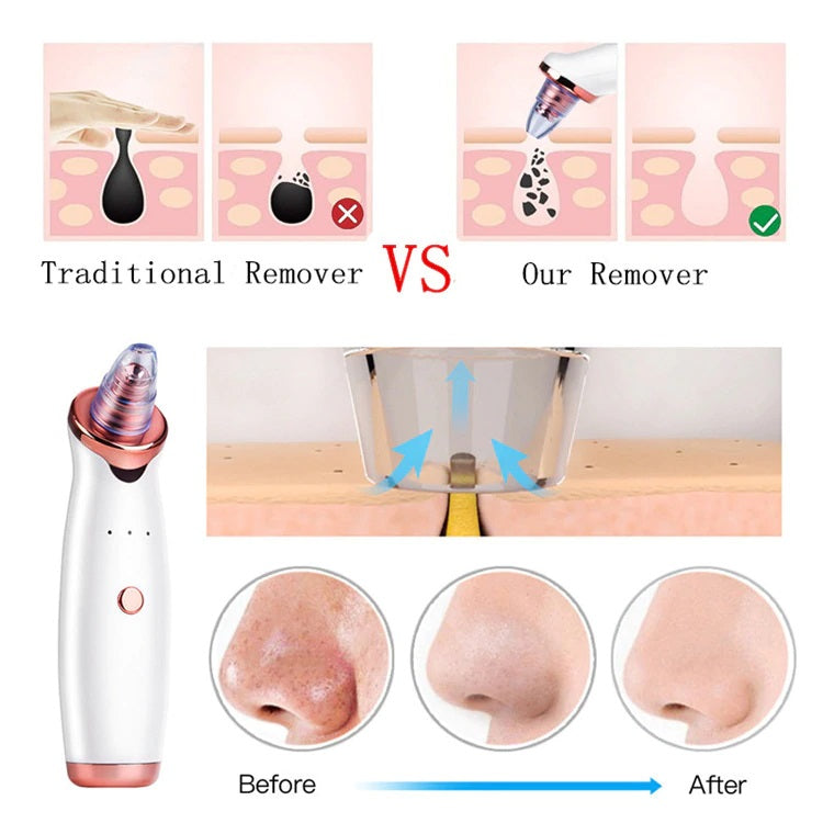 Blackhead Remover Facial Electric Acne Cleaner Blackhead Black Point Vacuum Cleaner Tool Black Spots Pore Cleaner Machine